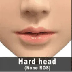 ハードヘッド-ROS無し