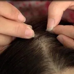 植髪の毛（人毛タイプ）