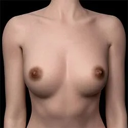 4#-XL
