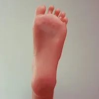 直立なし