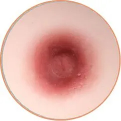 NO.3