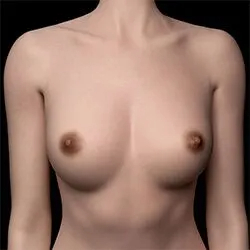 3#-L